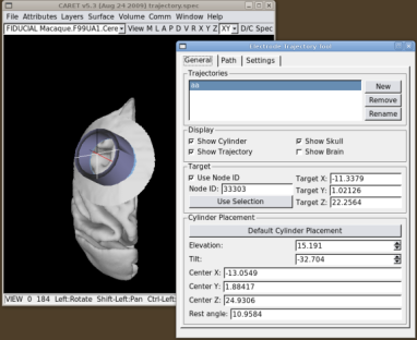 Select default cylinder placement after choosing a node.